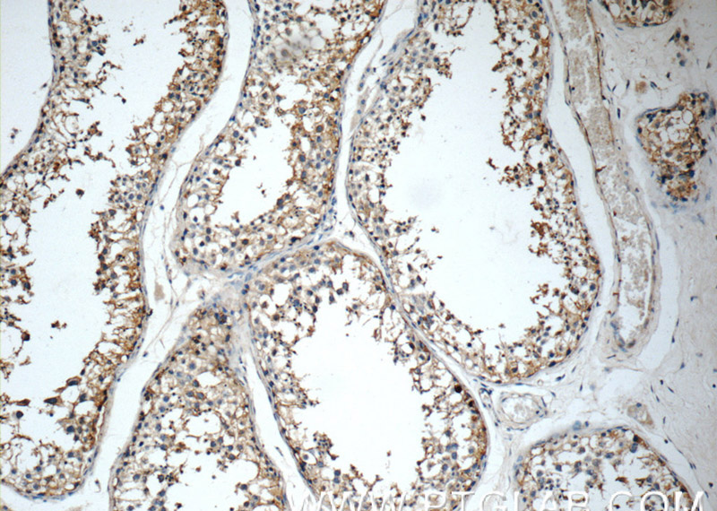 Immunohistochemistry of paraffin-embedded human testis tissue slide using Catalog No:111172(GSK3B Antibody) at dilution of 1:50 (under 10x lens)