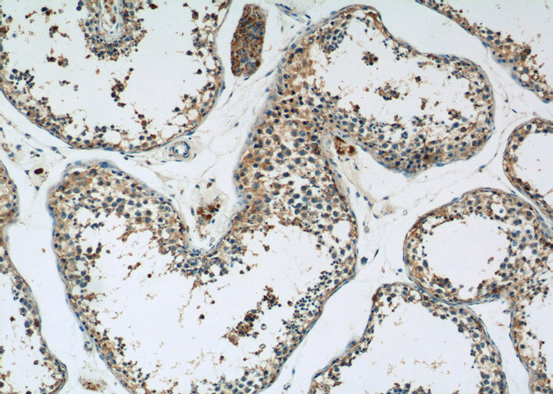 Immunohistochemistry of paraffin-embedded human testis tissue slide using Catalog No:111578(HYAL4 Antibody) at dilution of 1:50 (under 10x lens)