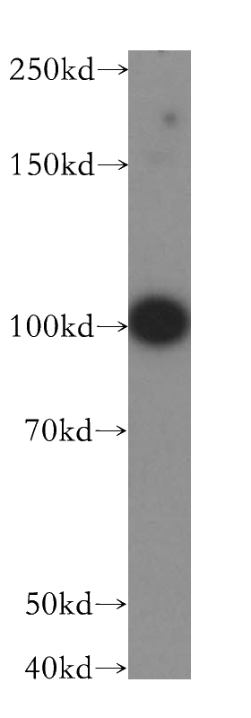 HepG2 cells were subjected to SDS PAGE followed by western blot with Catalog No:112150(LARS2 antibody) at dilution of 1:400