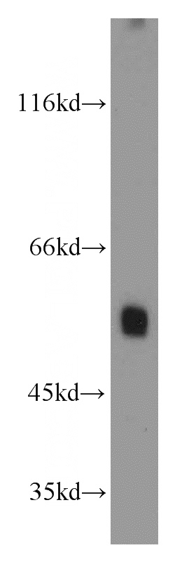 PC-3 cells were subjected to SDS PAGE followed by western blot with Catalog No:108289(ATG12 antibody) at dilution of 1:800