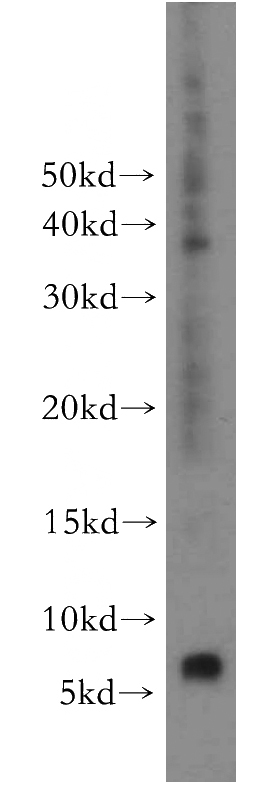 HeLa cells were subjected to SDS PAGE followed by western blot with Catalog No:114894(RPL38 antibody) at dilution of 1:500