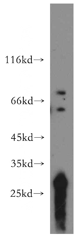 HL-60 cells were subjected to SDS PAGE followed by western blot with Catalog No:115910(TCIRG1 antibody) at dilution of 1:300