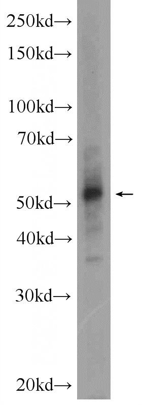 RAW 264.7 cells were subjected to SDS PAGE followed by western blot with Catalog No:115223(SETD6 Antibody) at dilution of 1:600