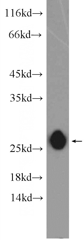 rat brain tissue were subjected to SDS PAGE followed by western blot with Catalog No:109214(CHCHD4 Antibody) at dilution of 1:1500