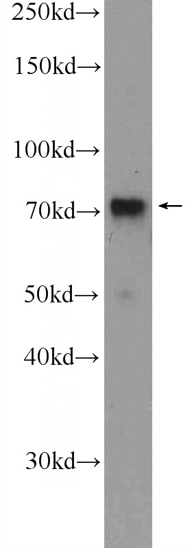 K-562 cells were subjected to SDS PAGE followed by western blot with Catalog No:114507(RACGAP1 Antibody) at dilution of 1:600