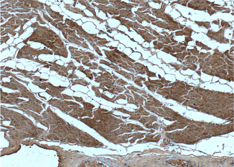 Immunohistochemistry of paraffin-embedded human heart tissue slide using Catalog No:107603(IL1RL1 Antibody) at dilution of 1:200 (under 10x lens).