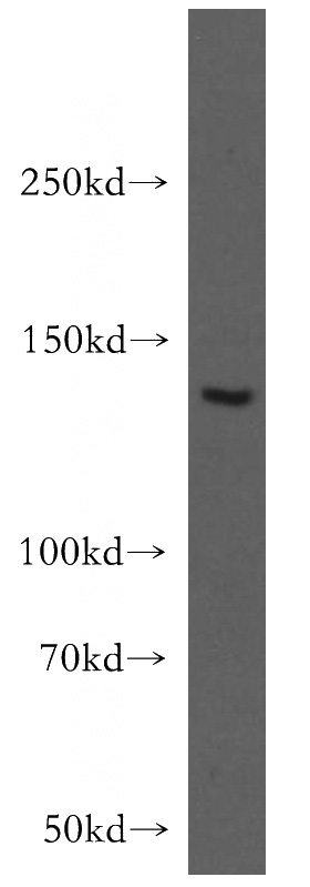 HEK-293 cells were subjected to SDS PAGE followed by western blot with Catalog No:108412(BAI3-Specific antibody) at dilution of 1:500