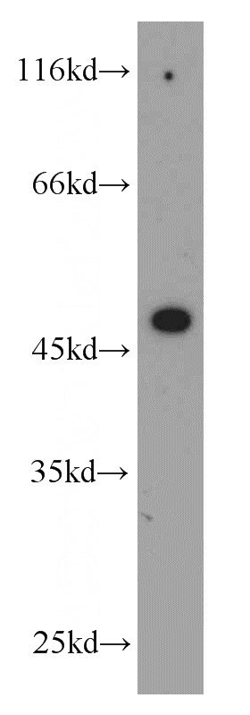 HEK-293 cells were subjected to SDS PAGE followed by western blot with Catalog No:110967(GHRHR antibody) at dilution of 1:500