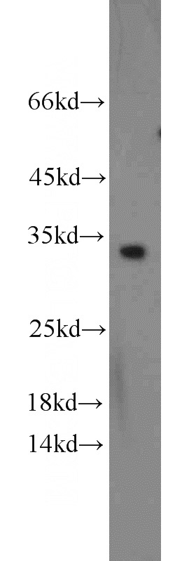 HeLa cells were subjected to SDS PAGE followed by western blot with Catalog No:109115(CDCA4 antibody) at dilution of 1:500