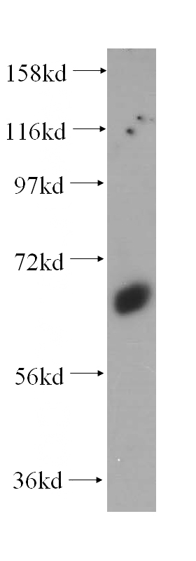 human liver tissue were subjected to SDS PAGE followed by western blot with Catalog No:115771(SYT1 antibody) at dilution of 1:1000