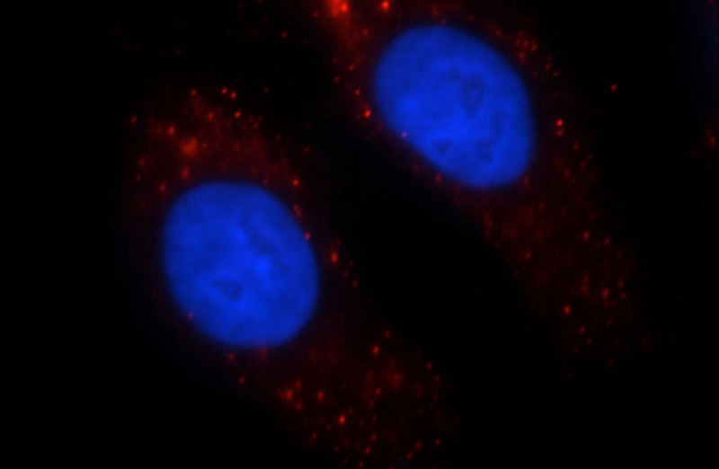Immunofluorescent analysis of HepG2 cells, using SHH antibody Catalog No:115273 at 1:25 dilution and Rhodamine-labeled goat anti-rabbit IgG (red). Blue pseudocolor = DAPI (fluorescent DNA dye).