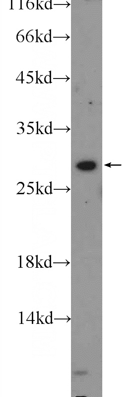 HEK-293 cells were subjected to SDS PAGE followed by western blot with Catalog No:116579(USE1 Antibody) at dilution of 1:300