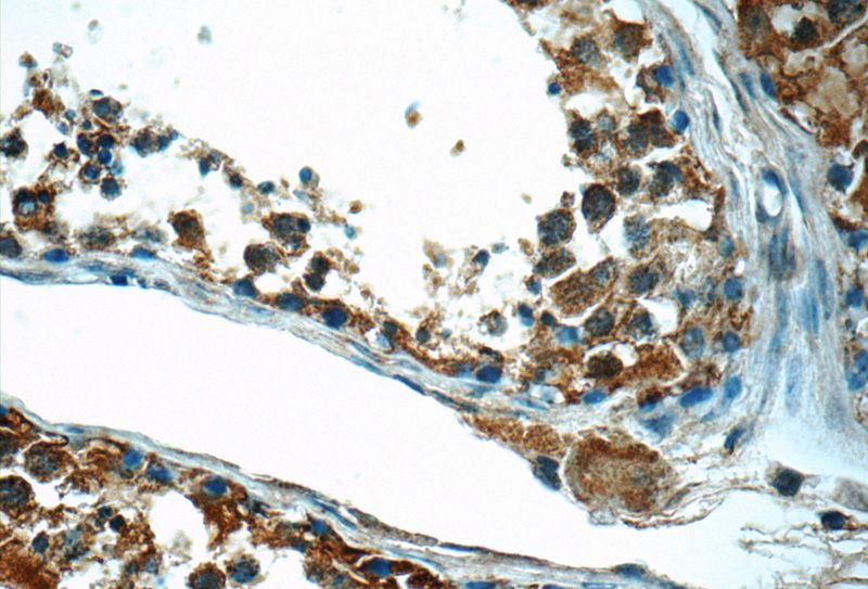 Immunohistochemistry of paraffin-embedded human testis tissue slide using Catalog No:109182(CEP55 Antibody) at dilution of 1:50 (under 40x lens)