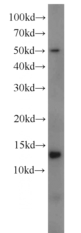 Y79 cells were subjected to SDS PAGE followed by western blot with Catalog No:112619(MIF antibody) at dilution of 1:1000