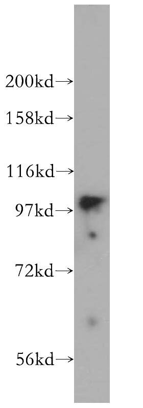 mouse lung tissue were subjected to SDS PAGE followed by western blot with Catalog No:112984(MYO1D antibody) at dilution of 1:200
