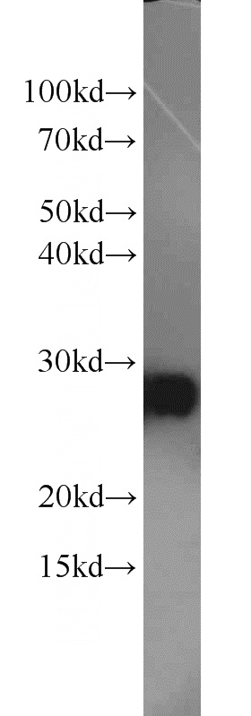 mouse thymus tissue were subjected to SDS PAGE followed by western blot with Catalog No:108661(CLE; C14orf166 antibody) at dilution of 1:1000