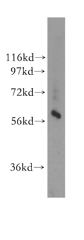 human kidney tissue were subjected to SDS PAGE followed by western blot with Catalog No:111242(GTPBP2 antibody) at dilution of 1:200