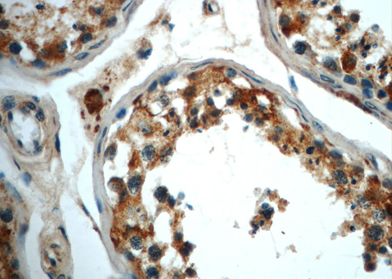 Immunohistochemistry of paraffin-embedded human testis slide using Catalog No:107962(ALDH1B1 Antibody) at dilution of 1:50