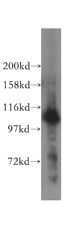 HeLa cells were subjected to SDS PAGE followed by western blot with Catalog No:114527(RAI14 antibody) at dilution of 1:400
