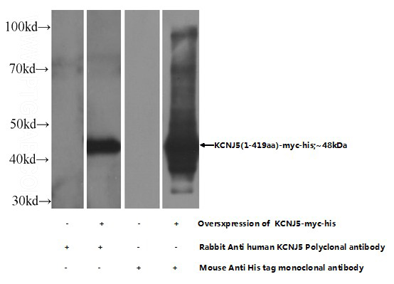 WB result of KCNJ5 antibody (Catalog No:111971) with transfected cell lysate. His tag antibody (Catalog No:117294) as control.