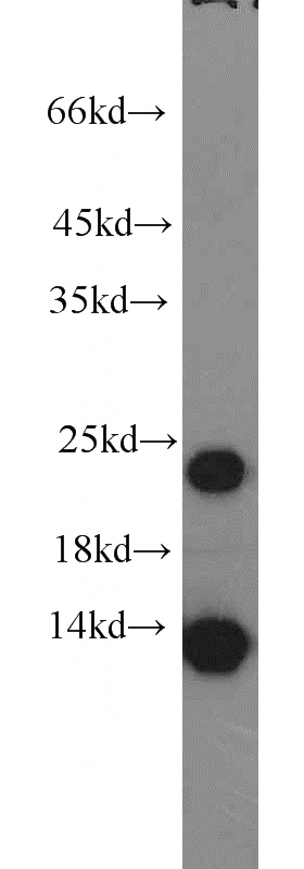 human skeletal muscle tissue were subjected to SDS PAGE followed by western blot with Catalog No:112939(MYL1 antibody) at dilution of 1:2000