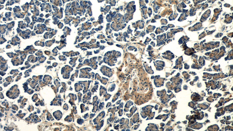 Immunohistochemistry of paraffin-embedded human pancreas tissue slide using Catalog No:107884(ALS2 Antibody) at dilution of 1:50 (under 10x lens)