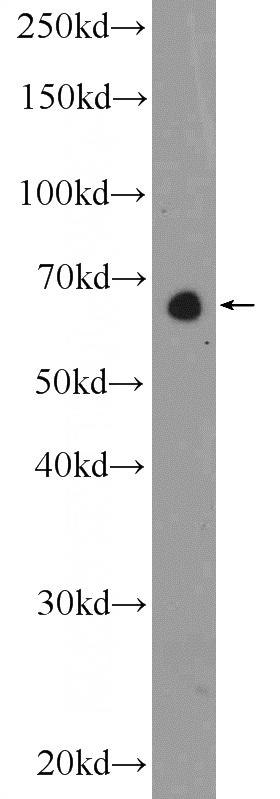 A549 cells were subjected to SDS PAGE followed by western blot with Catalog No:110885(GATAD2B Antibody) at dilution of 1:1000