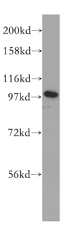 SMMC-7721 cells were subjected to SDS PAGE followed by western blot with Catalog No:111044(GOLGA1 antibody) at dilution of 1:500