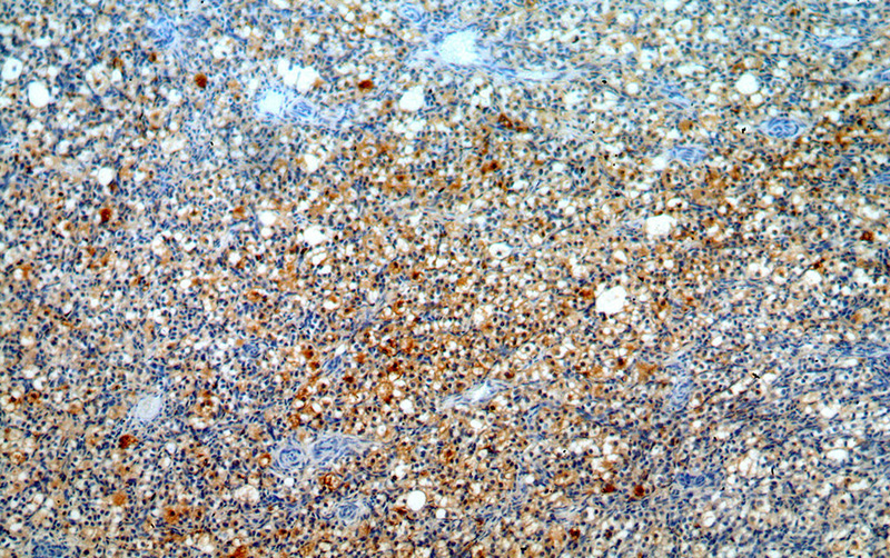 Immunohistochemical of paraffin-embedded human ovary using Catalog No:112756(MPRIP antibody) at dilution of 1:100 (under 10x lens)