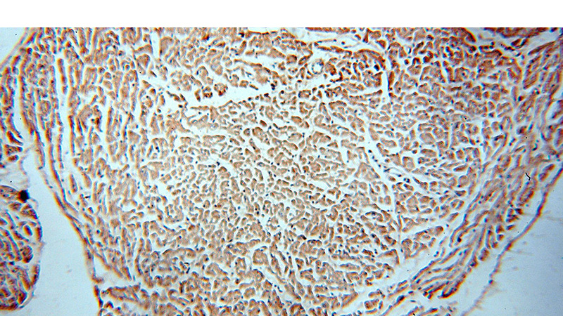 Immunohistochemical of paraffin-embedded human heart using Catalog No:109439(COL6A2 antibody) at dilution of 1:50 (under 10x lens)