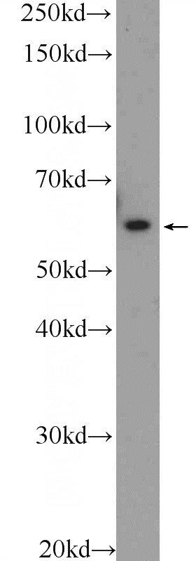 HL-60 cells were subjected to SDS PAGE followed by western blot with Catalog No:112402(LY6G6F Antibody) at dilution of 1:1000