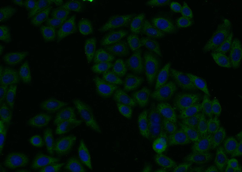 Immunofluorescent analysis of HeLa cells using Catalog No:114855(C22orf28 Antibody) at dilution of 1:25 and Alexa Fluor 488-congugated AffiniPure Goat Anti-Rabbit IgG(H+L)