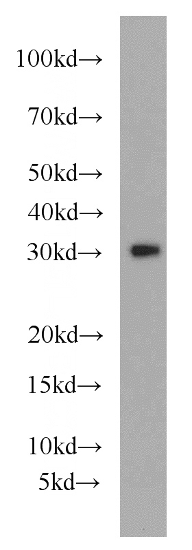 A375 cells were subjected to SDS PAGE followed by western blot with Catalog No:112821(MRPL28 antibody) at dilution of 1:500
