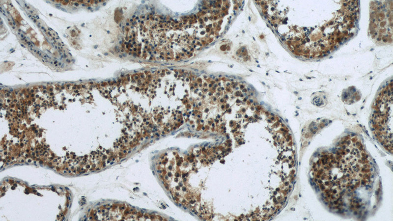 Immunohistochemistry of paraffin-embedded human testis tissue slide using Catalog No:111705(HSPH1 Antibody) at dilution of 1:50 (under 10x lens)