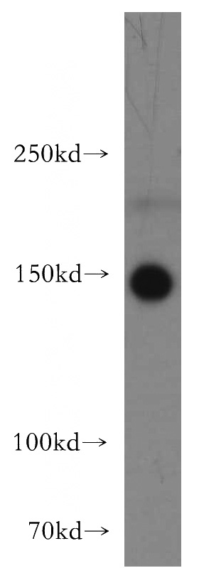 mouse brain tissue were subjected to SDS PAGE followed by western blot with Catalog No:115848(TAOK2 antibody) at dilution of 1:300