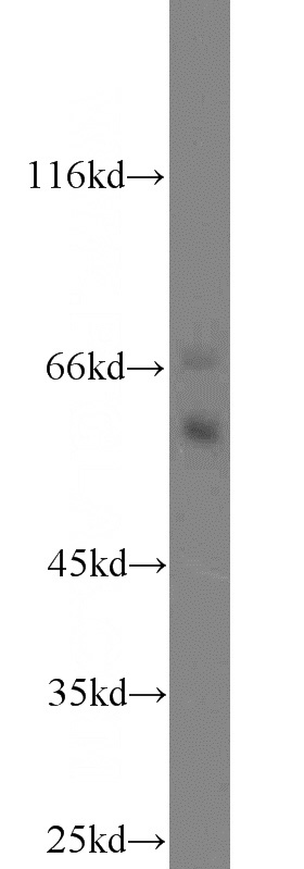LPS treated HEK-293 cells were subjected to SDS PAGE followed by western blot with Catalog No:109488(PTGS2 antibody) at dilution of 1:600