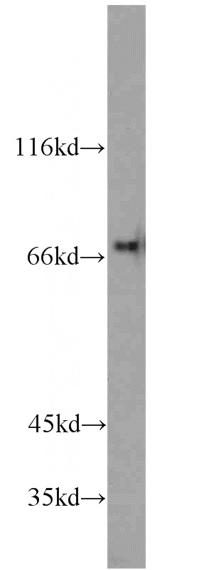 Raji cells were subjected to SDS PAGE followed by western blot with Catalog No:111778(IL21R antibody) at dilution of 1:500