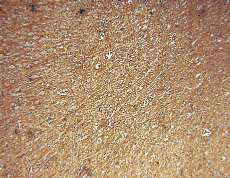 Immunohistochemical of paraffin-embedded human brain using Catalog No:108743(CA11 antibody) at dilution of 1:50 (under 10x lens)