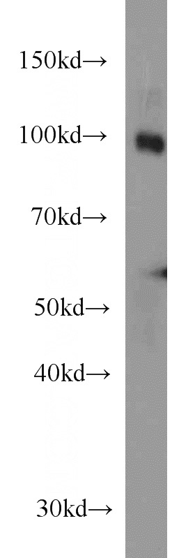 human brain tissue were subjected to SDS PAGE followed by western blot with Catalog No:107522(SEC5 antibody) at dilution of 1:1000