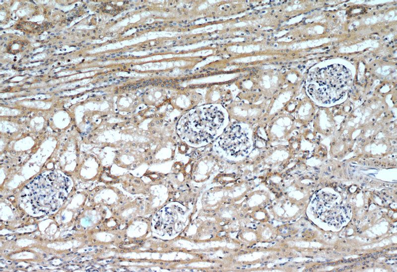 Immunohistochemistry of paraffin-embedded human kidney slide using Catalog No:111460(HRAS-Specific Antibody) at dilution of 1:50