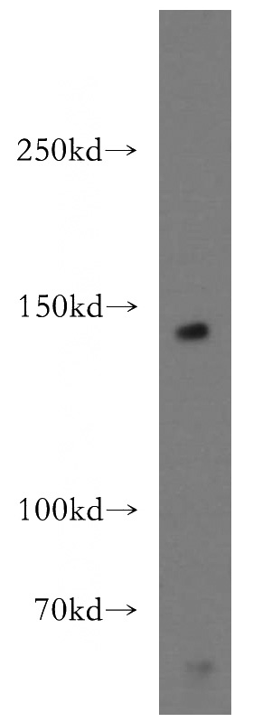 HEK-293 cells were subjected to SDS PAGE followed by western blot with Catalog No:114984(SCAP antibody) at dilution of 1:300