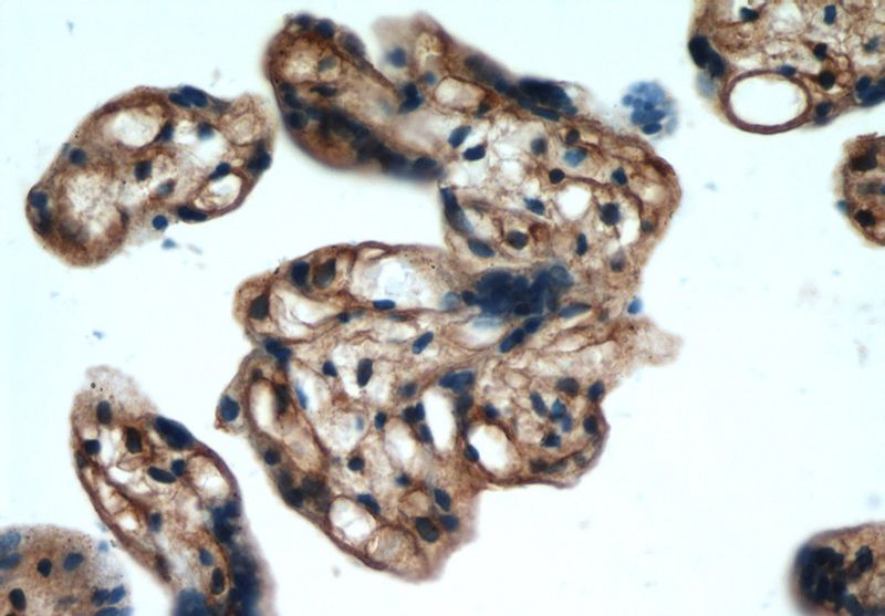 Immunohistochemical of paraffin-embedded human placenta using Catalog No:108169(ARPC5L antibody) at dilution of 1:50 (under 40x lens)