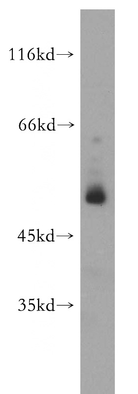 A549 cells were subjected to SDS PAGE followed by western blot with Catalog No:113711(PER1 antibody) at dilution of 1:300