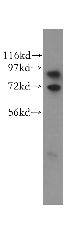 HeLa cells were subjected to SDS PAGE followed by western blot with Catalog No:115687(STAT3 antibody) at dilution of 1:400