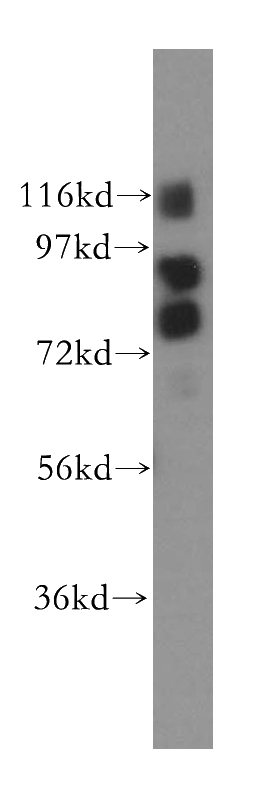 K-562 cells were subjected to SDS PAGE followed by western blot with Catalog No:110856(ADD3 antibody) at dilution of 1:300