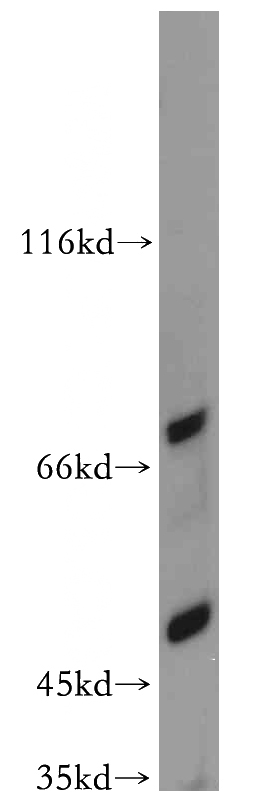 mouse colon tissue were subjected to SDS PAGE followed by western blot with Catalog No:117121(BEST3 antibody) at dilution of 1:200