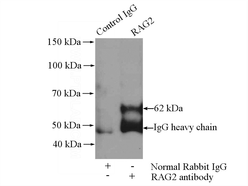 IP Result of anti-RAG2 (IP:Catalog No:114525, 4ug; Detection:Catalog No:114525 1:300) with A375 cells lysate 3600ug.