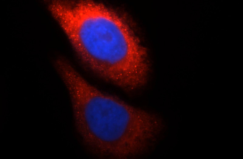Immunofluorescent analysis of HepG2 cells, using CTBS antibody Catalog No:109718 at 1:25 dilution and Rhodamine-labeled goat anti-rabbit IgG (red). Blue pseudocolor = DAPI (fluorescent DNA dye).