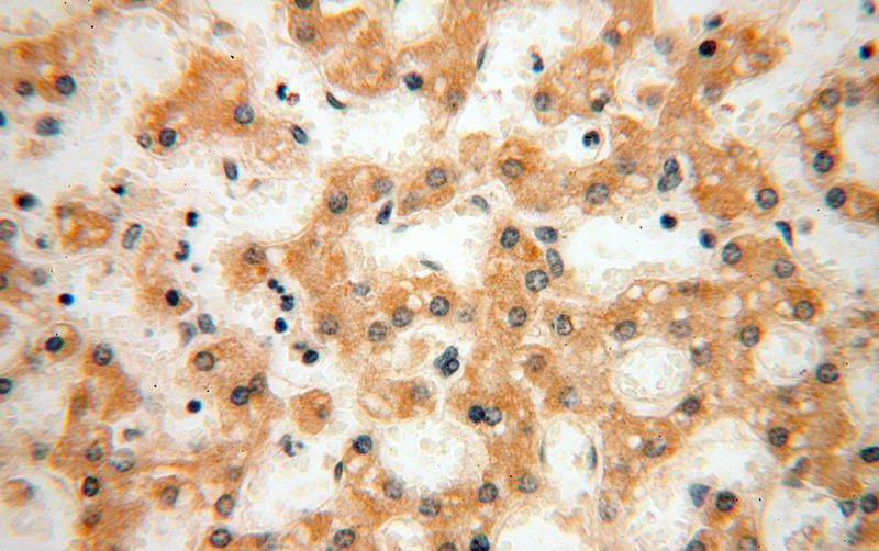 Immunohistochemical of paraffin-embedded human liver using Catalog No:112817(MRPL21 antibody) at dilution of 1:100 (under 40x lens)