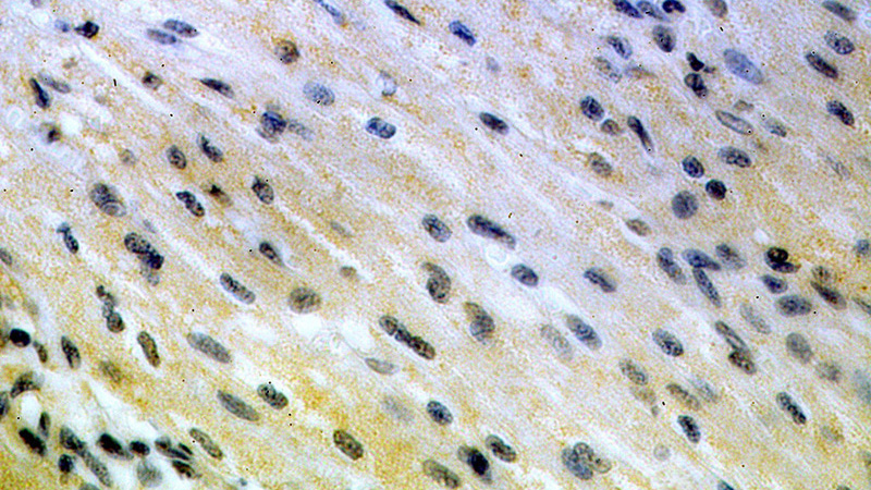 Immunohistochemical of paraffin-embedded human heart using Catalog No:113520(OVCA1 antibody) at dilution of 1:50 (under 40x lens)